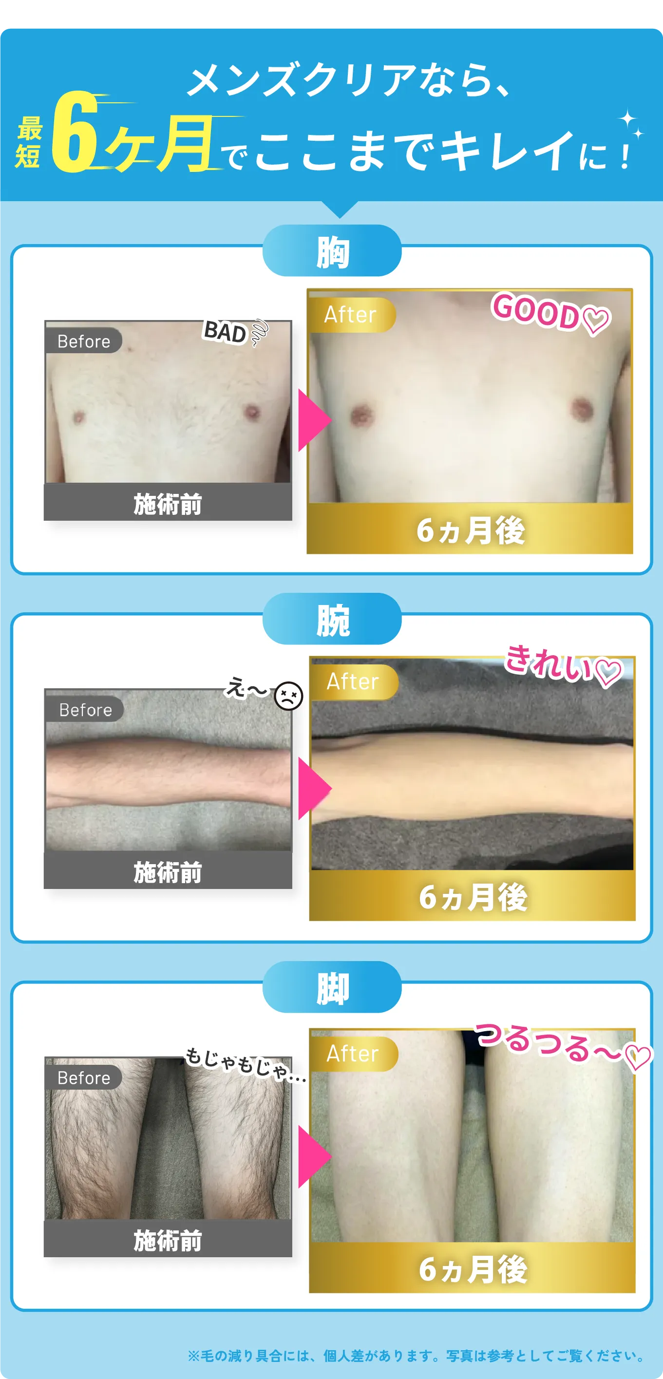 メンズクリアなら 最短6ヶ月でここまでキレイに!