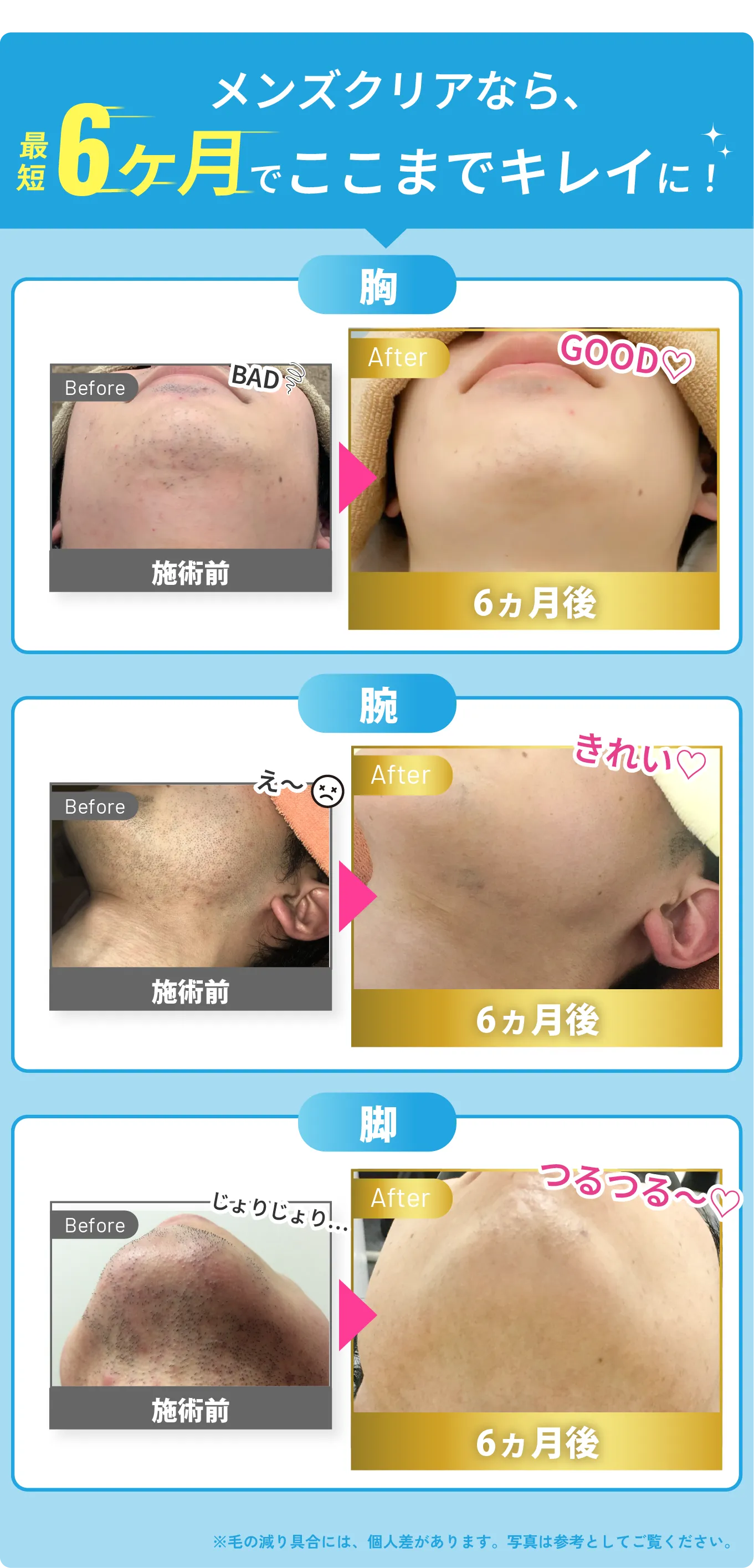 メンズクリアなら 最短6ヶ月でここまでキレイに!