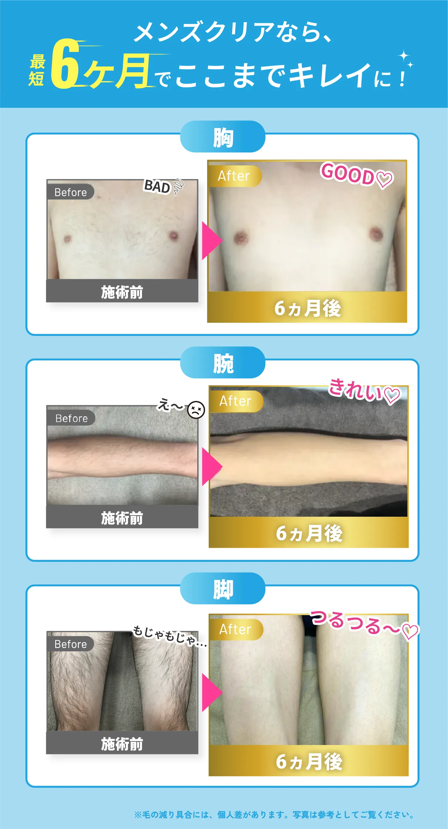 メンズクリアなら 最短6ヶ月でここまでキレイに!