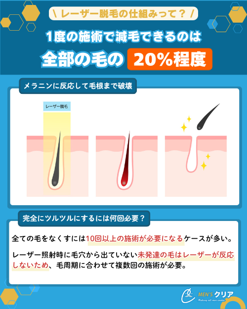 ヒゲ脱毛_どのくらいなくなる