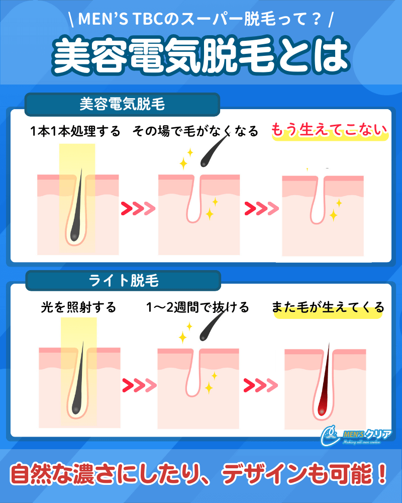 サロン脱毛_メンズ_美容電気脱毛