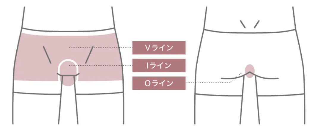 脱毛サロン_メンズ_レイロール_VIO_体験価格