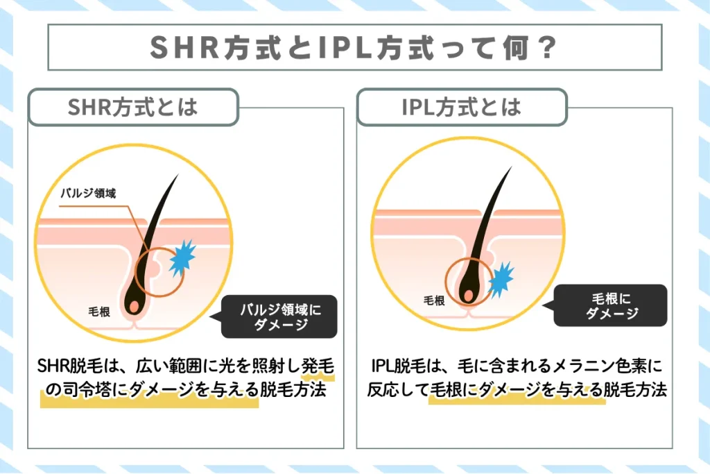 SHR方式 IPL方式 解説