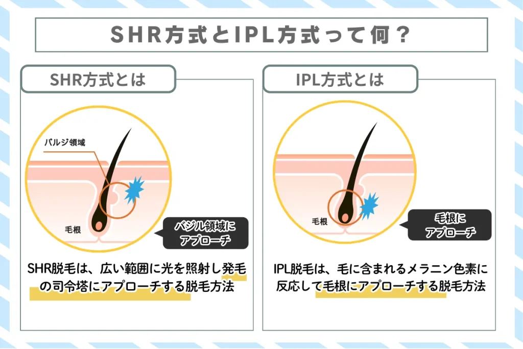 SHR方式　IPL方式　解説