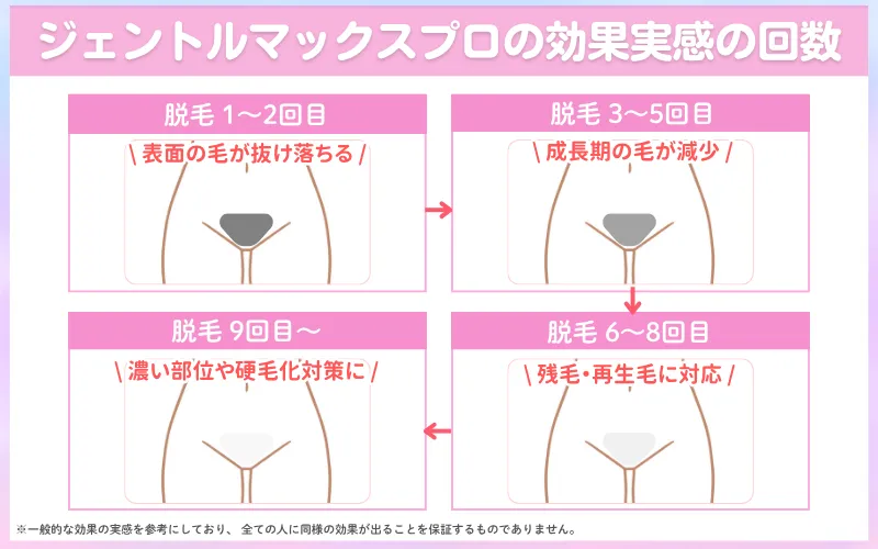 ジェントルマックスプロ　東京　効果回数