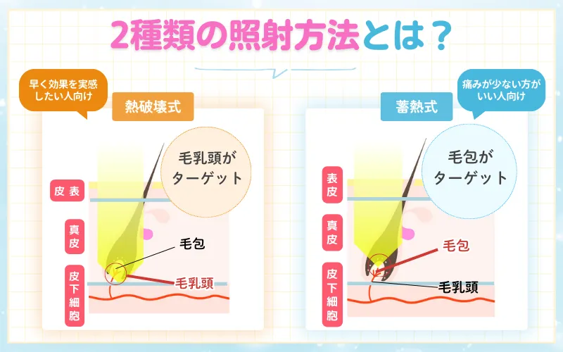 医療脱毛　機械　照射方法