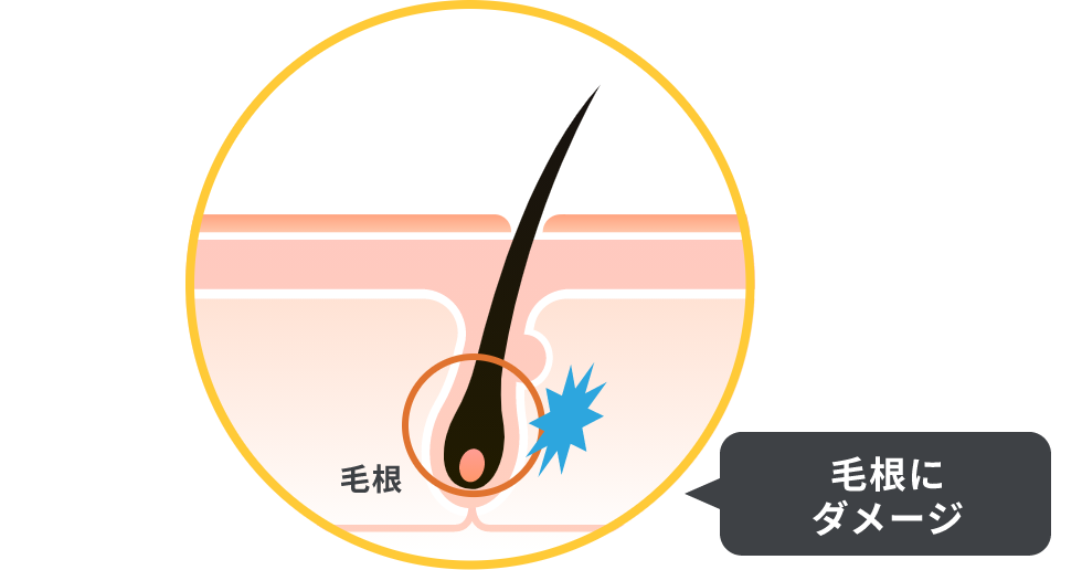毛根にダメージ