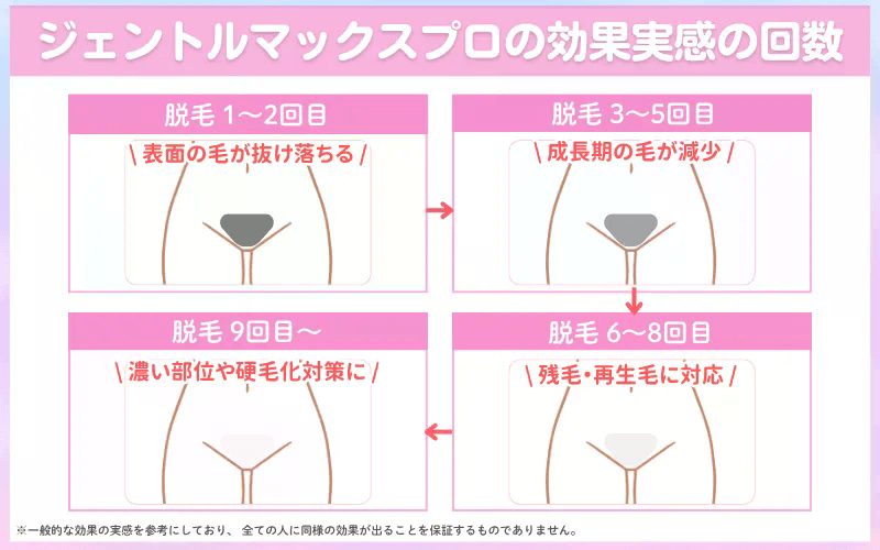 ジェントルマックスプロ 東京 効果回数