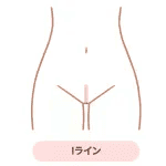 VIO脱毛_とは_アイライン