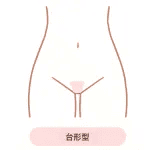 VIO脱毛_とは_台形型
