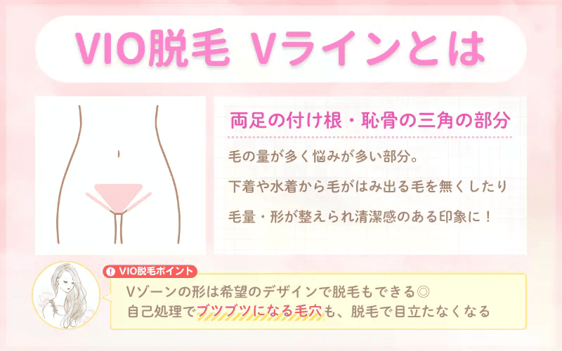 VIO脱毛_とは_Vライン