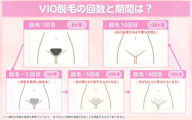 VIO脱毛_回数